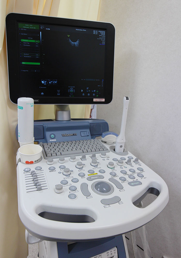エコー検査器（内診室）